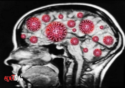 نوع شدید کووید ۱۹ مغز بازماندگان را تا ۲۰ سال پیر می کند
