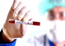 ۱۰۴ نفر مبتلای جدید به ویروس کرونا در استان فارس شناسایی شد