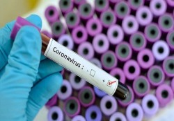 ۸۵ مورد جدید ابتلا به کرونا ویروس در فارس شناسایی شد
